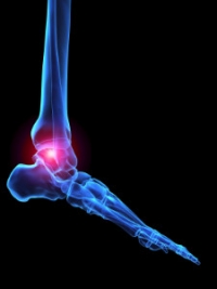 Are There Relief Options for Arthritic Foot Pain?
