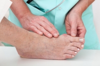 Nonsurgical Treatments for Bunions
