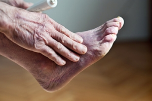 Signs of Poor Circulation in the Feet