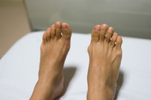 Recognizing the Early Signs of Bunions