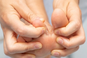 Understanding Athlete&#039;s Foot
